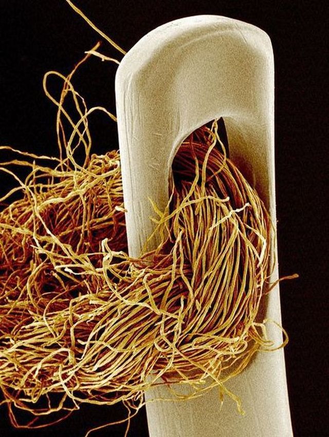 everyday-items-under-a-microscope-27-pics_1.jpg