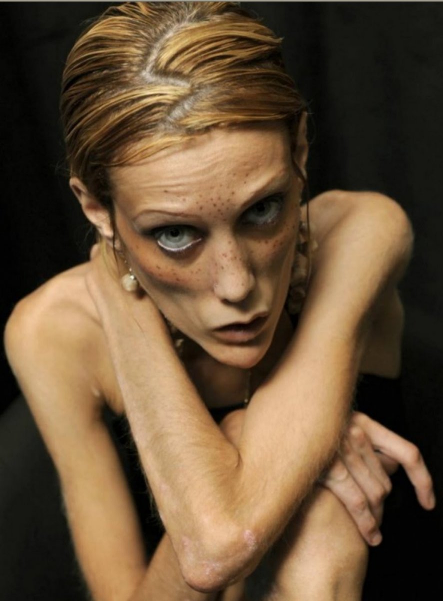 Isabelle_caro_anorexia__15.jpg