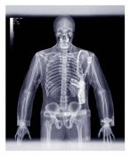 xray_03.jpg