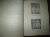 Эпедемический зоб в Азербойджанской ССР -1939г