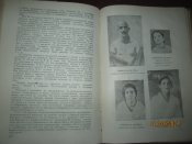 Эпедемический зоб в Азербойджанской ССР -1939г