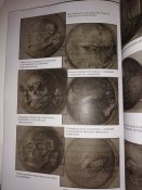 Металлическая символика фашистской Германии. Последняя.