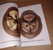 Каски l мировой + Каски ll мировой (Три тома).