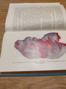 "Военно-полевая хирургия: руководство для врачей и студентов". Вишневский А.А., Шрайбер М. И.