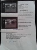 20160908_171536.jpg